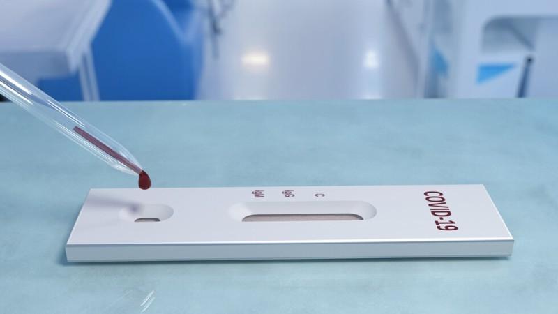 Продукт БЪРЗ ТЕСТ ЗА КОРОНАВИРУС COVID-19 IgG - IgM - 5бр в опаковкана ниска цена с бърза доставка - BestPC.BG