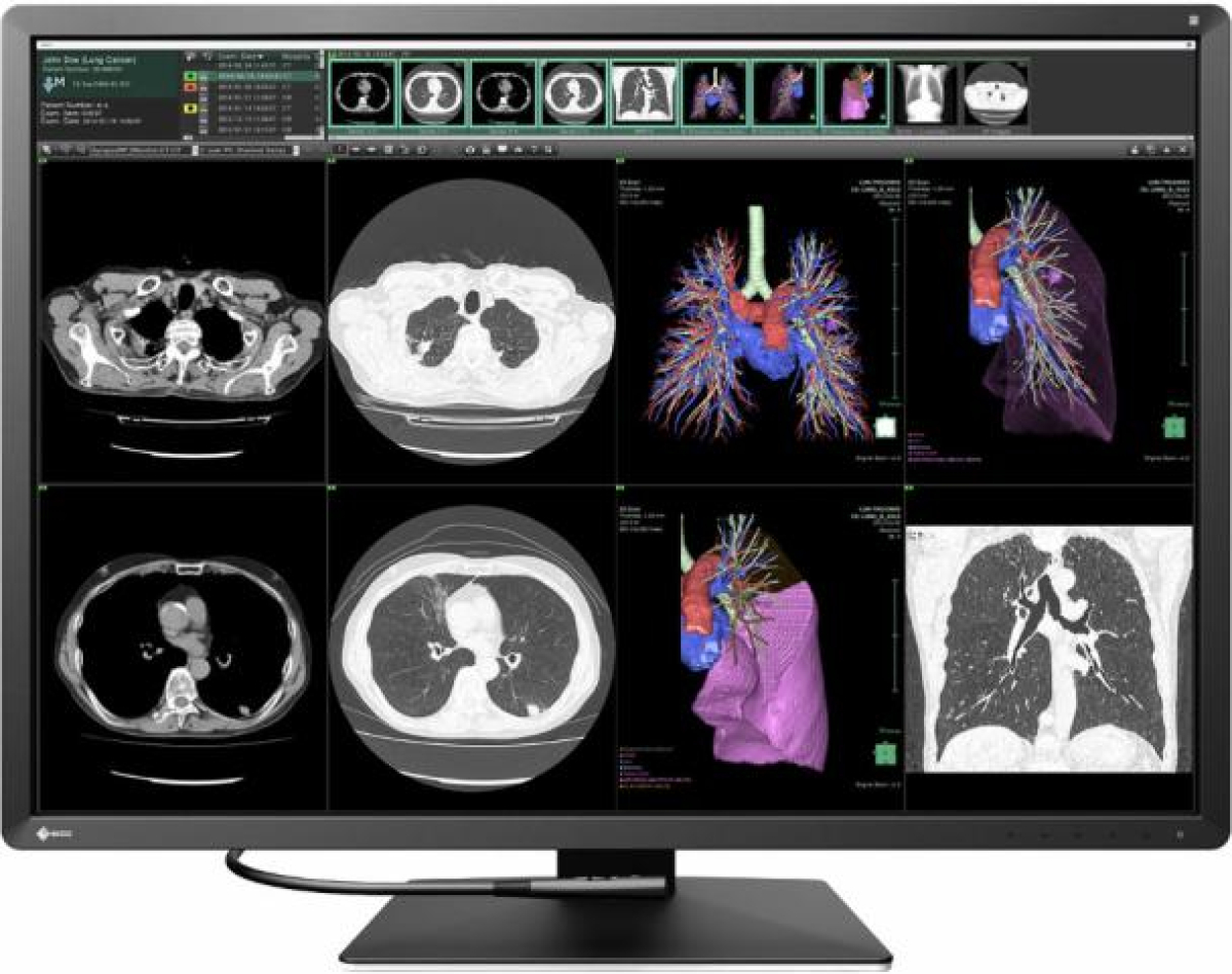 Медицински монитор EIZO RadiForce RX1270 12MP Цветенна ниска цена с бърза доставка - BestPC.BG