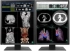 Медицински монитор EIZO Radi Force RX270 - 21.3 инч, 2MP Цветен LED снимка 2